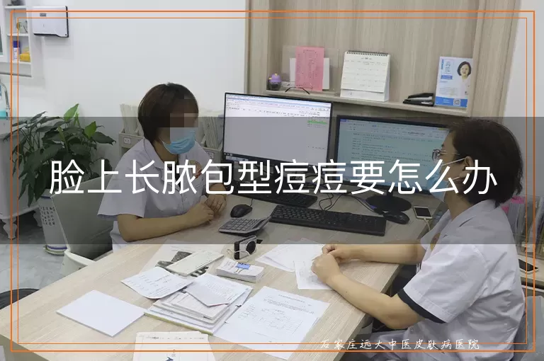脸上长脓包型痘痘要怎么办