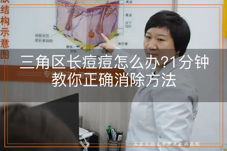 三角区长痘痘怎么办?1分钟教你正确消除方法
