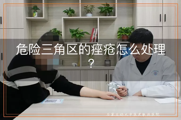 危险三角区的痤疮怎么处理?
