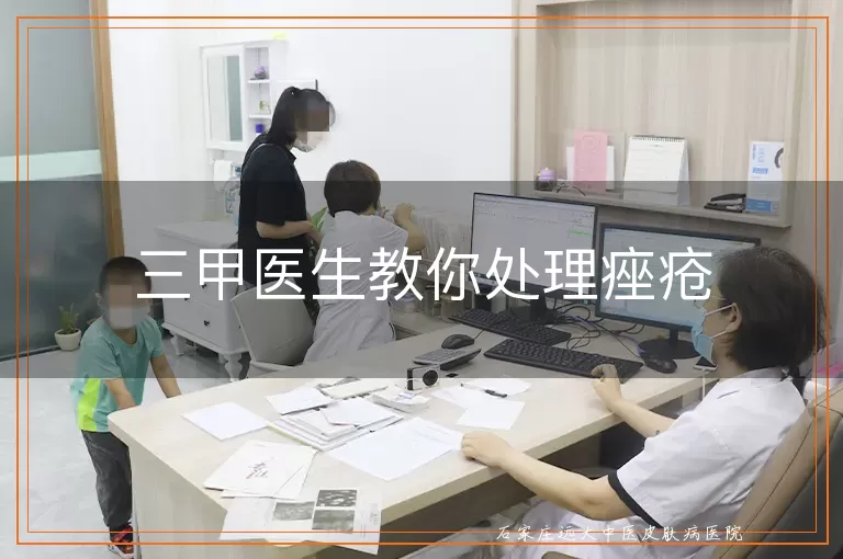 三甲医生教你处理痤疮