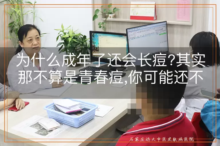 为什么成年了还会长痘?其实那不算是青春痘,你可能还不知道吧