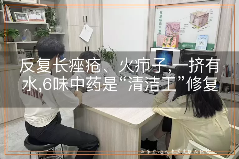 反复长痤疮、火疖子,一挤有水,6味中药是“清洁工”修复皮肤