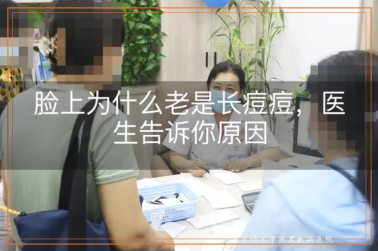 脸上为什么老是长痘痘，医生告诉你原因