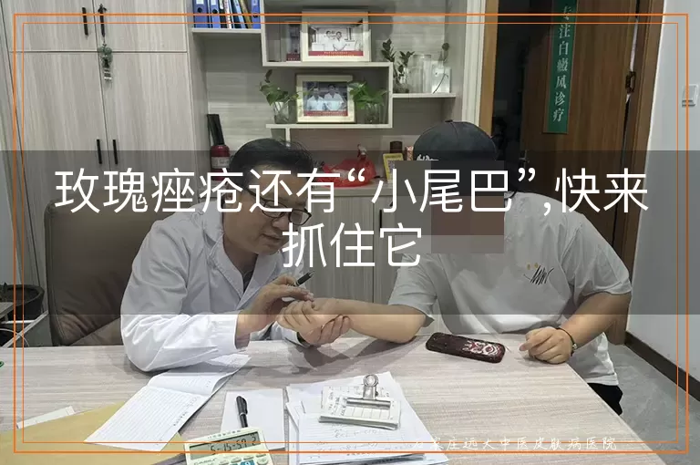 玫瑰痤疮还有“小尾巴”,快来抓住它