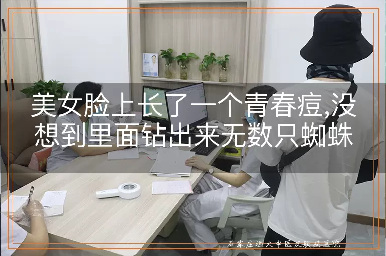 美女脸上长了一个青春痘,没想到里面钻出来无数只蜘蛛!