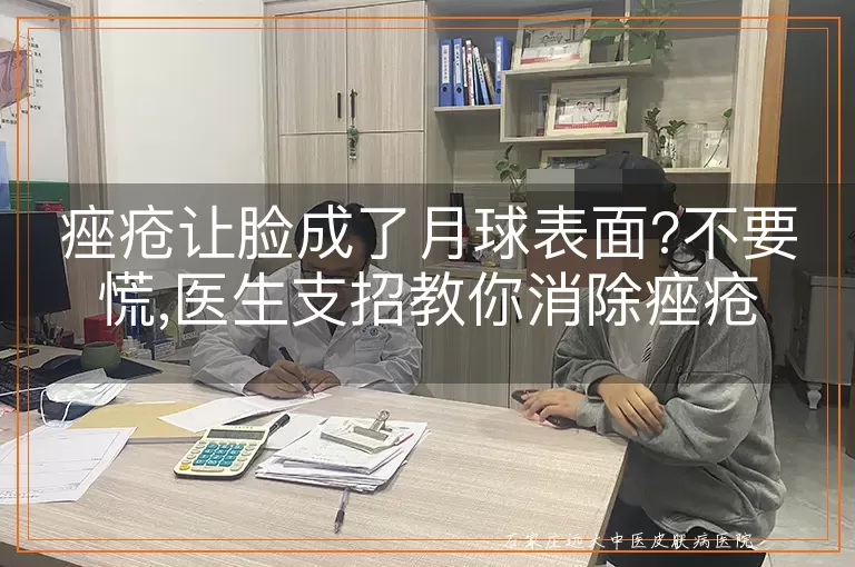 痤疮让脸成了月球表面?不要慌,医生支招教你消除痤疮