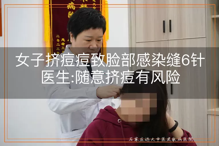 女子挤痘痘致脸部感染缝6针医生:随意挤痘有风险