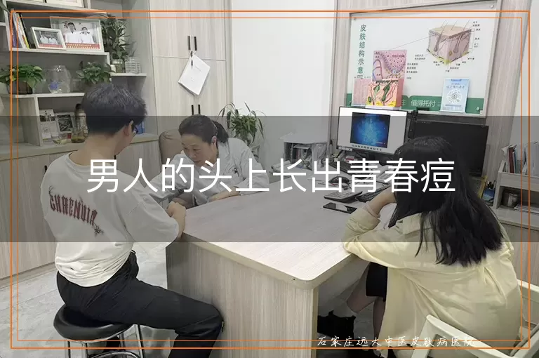 男人的头上长出青春痘