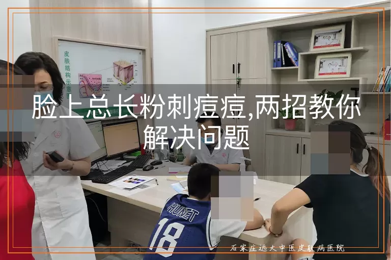 脸上总长粉刺痘痘,两招教你解决问题