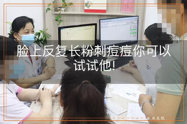 脸上反复长粉刺痘痘你可以试试他!