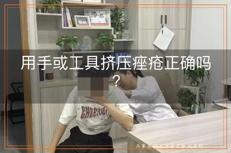 用手或工具挤压痤疮正确吗?