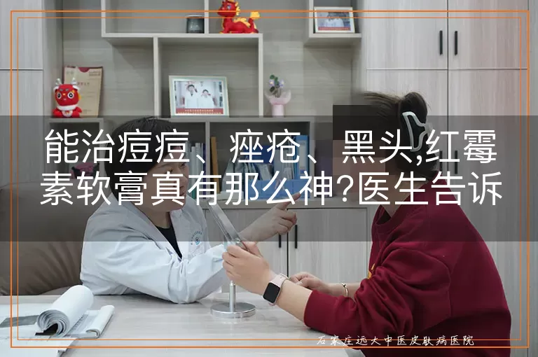 能治痘痘、痤疮、黑头,红霉素软膏真有那么神?医生告诉你真相