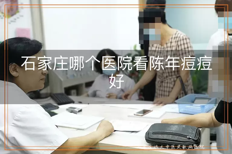 石家庄哪个医院看陈年痘痘好
