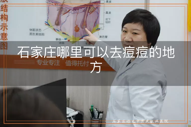 石家庄哪里可以去痘痘的地方