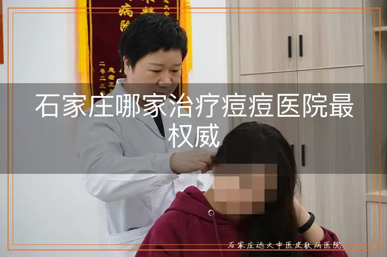 石家庄哪家治疗痘痘医院最权威