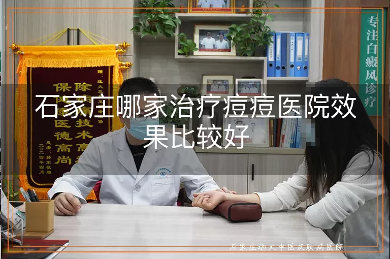 石家庄哪家治疗痘痘医院效果比较好