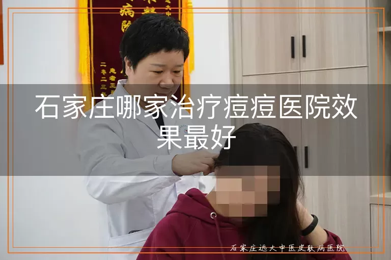 石家庄哪家治疗痘痘医院效果最好