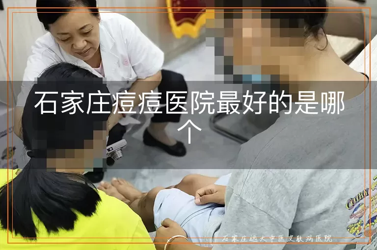石家庄痘痘医院最好的是哪个