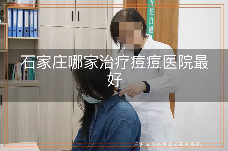 石家庄哪家治疗痘痘医院最好