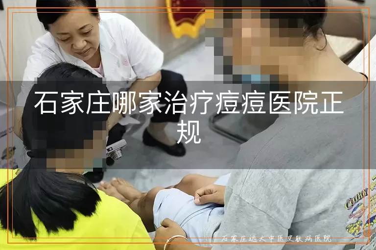 石家庄哪家治疗痘痘医院正规