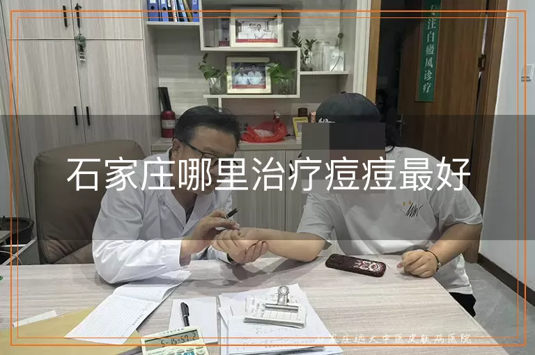石家庄哪里治疗痘痘最好