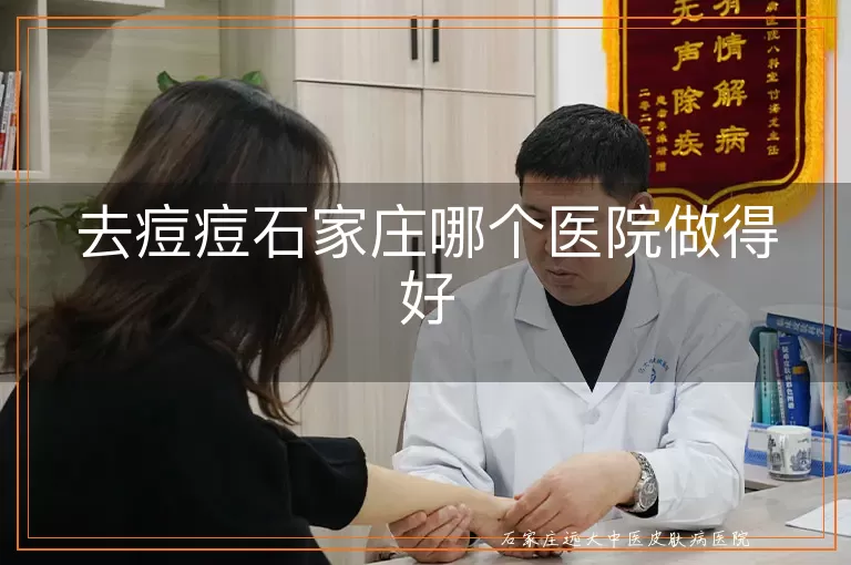 去痘痘石家庄哪个医院做得好