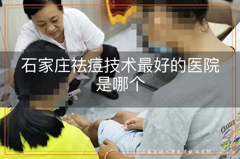 石家庄祛痘技术最好的医院是哪个