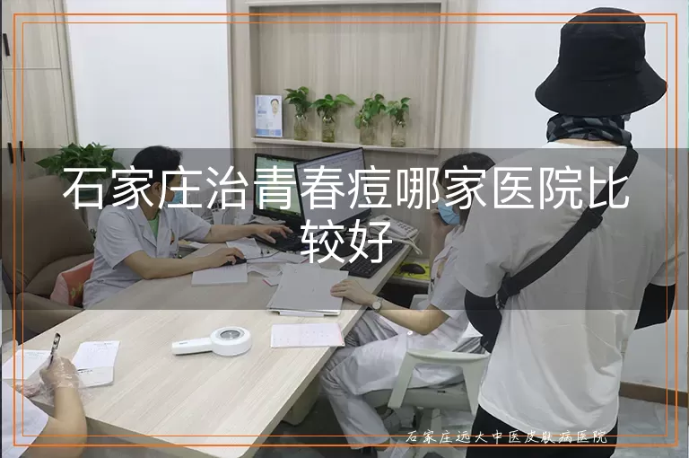 石家庄治青春痘哪家医院比较好