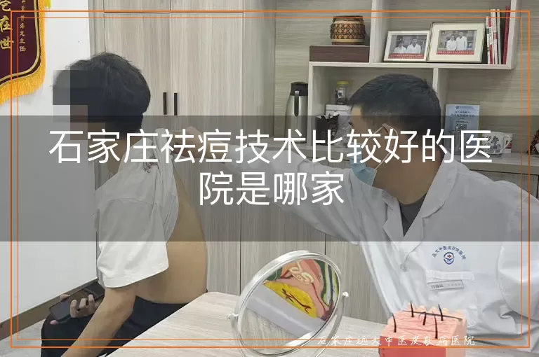 石家庄祛痘技术比较好的医院是哪家