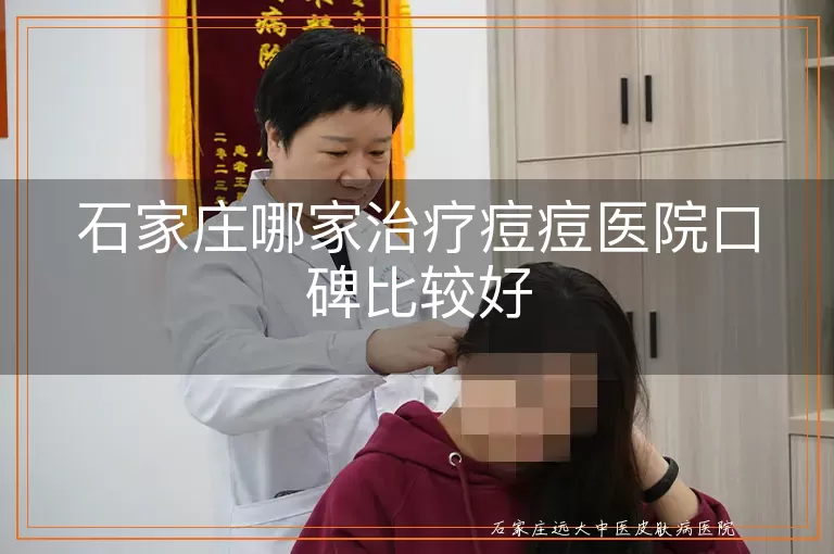 石家庄哪家治疗痘痘医院口碑比较好