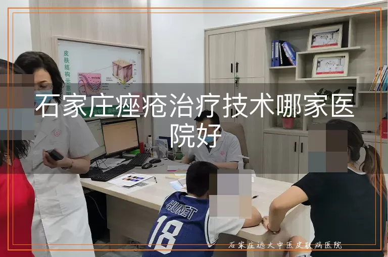 石家庄痤疮治疗技术哪家医院好