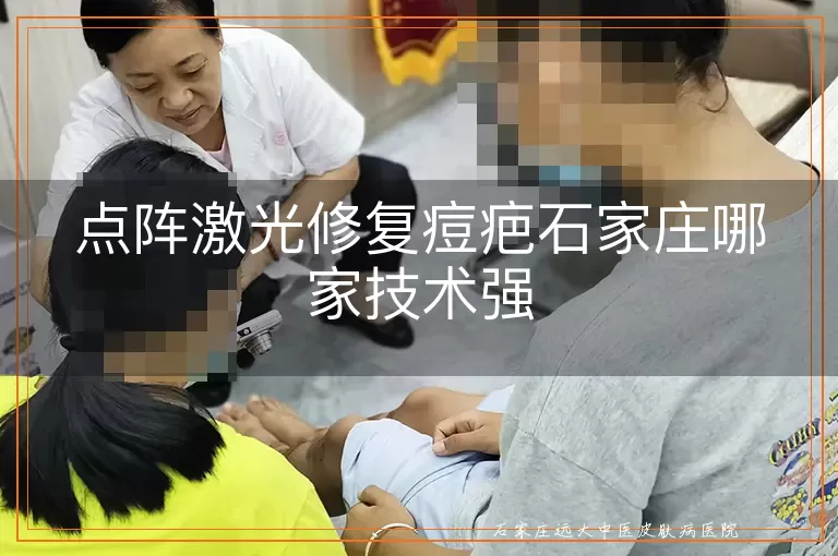 点阵激光修复痘疤石家庄哪家技术强