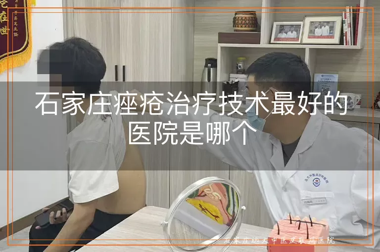 石家庄痤疮治疗技术最好的医院是哪个