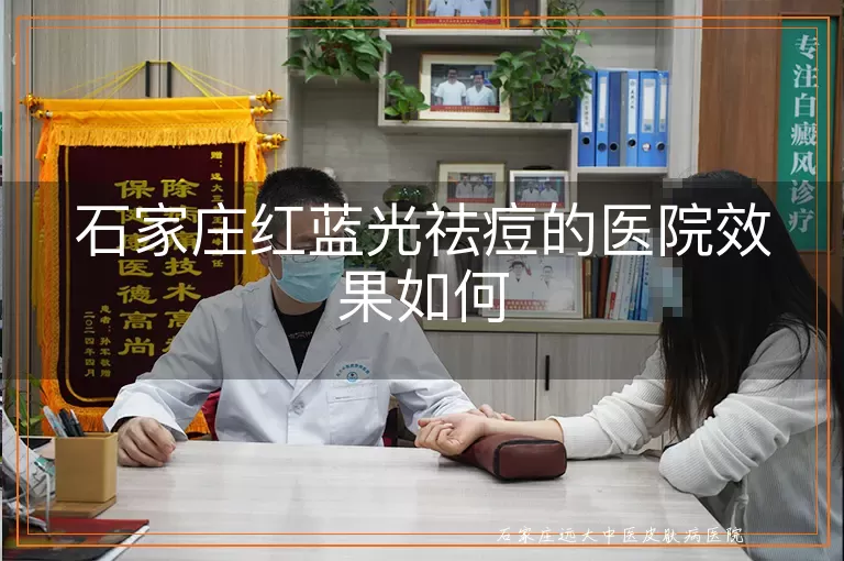 石家庄红蓝光祛痘的医院效果如何