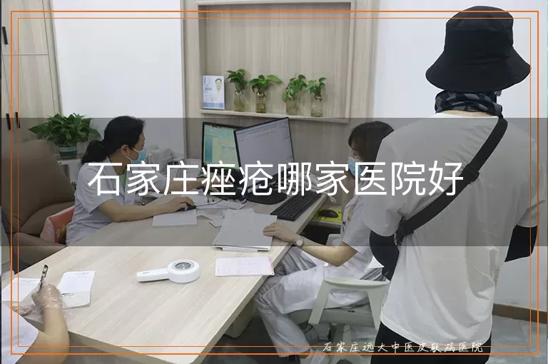 石家庄痤疮哪家医院好