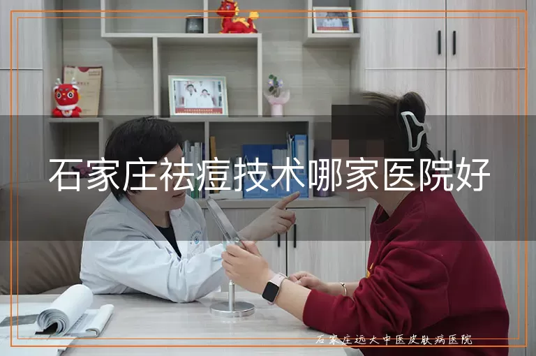 石家庄祛痘技术哪家医院好