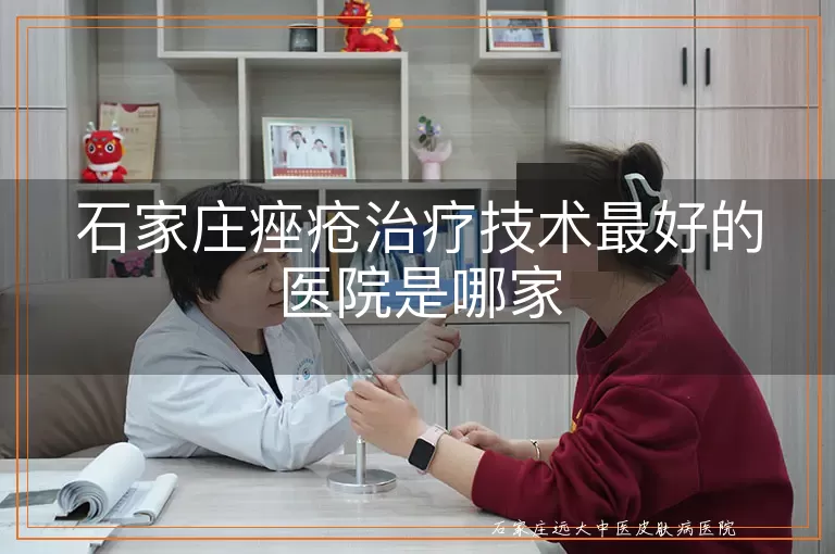 石家庄痤疮治疗技术最好的医院是哪家