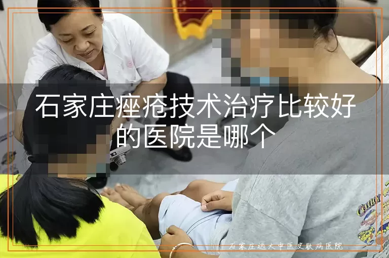 石家庄痤疮技术治疗比较好的医院是哪个