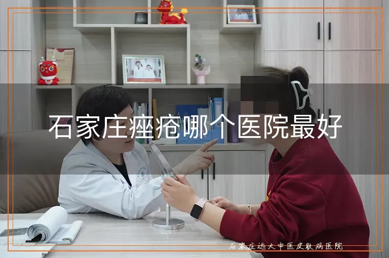 石家庄痤疮哪个医院最好