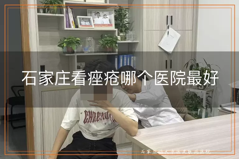 石家庄看痤疮哪个医院最好