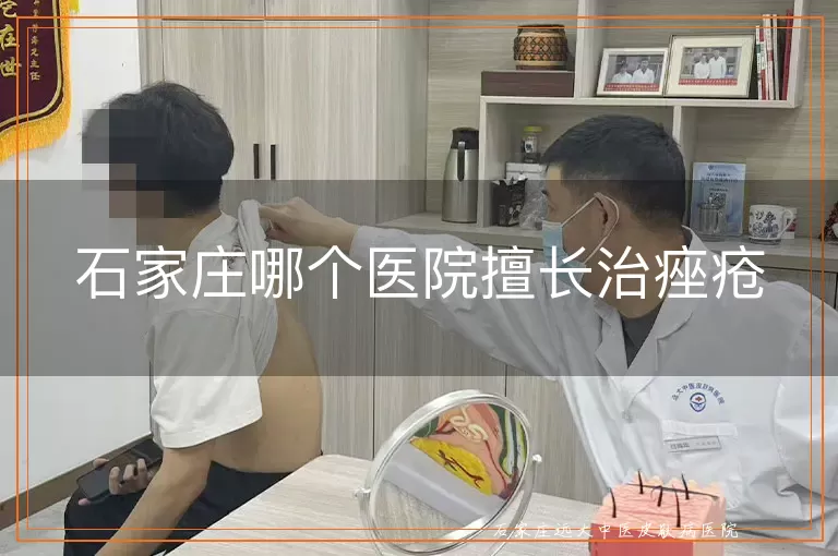 石家庄哪个医院擅长治痤疮