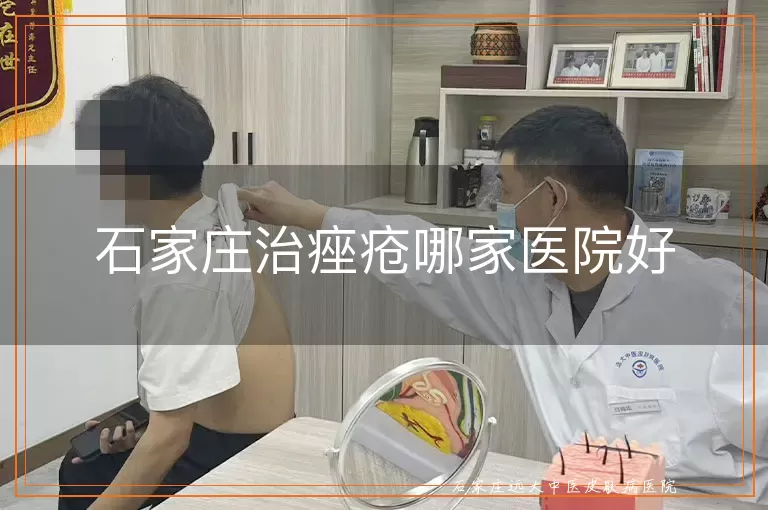 石家庄治痤疮哪家医院好