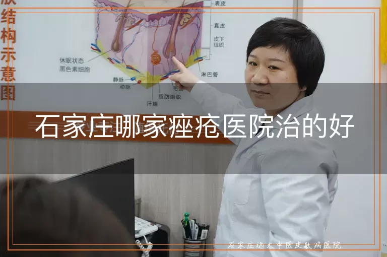 石家庄哪家痤疮医院治的好