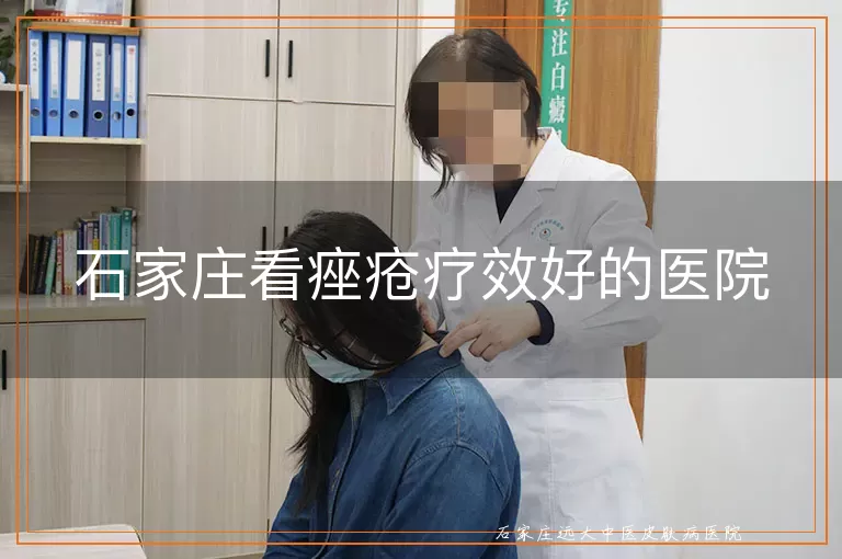 石家庄看痤疮疗效好的医院