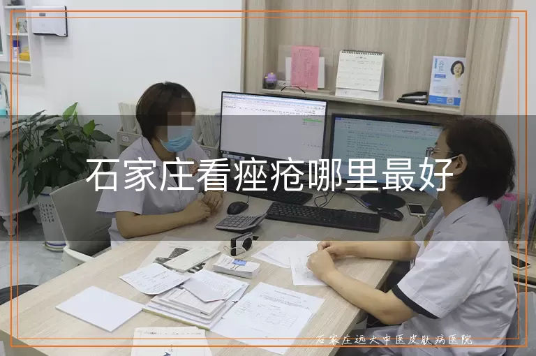 石家庄看痤疮哪里最好