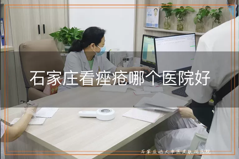 石家庄看痤疮哪个医院好