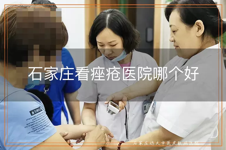 石家庄看痤疮医院哪个好