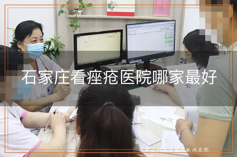石家庄看痤疮医院哪家最好