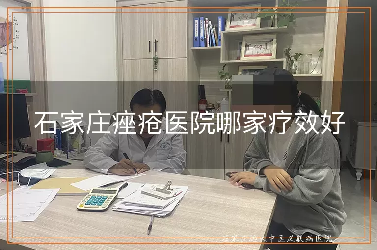 石家庄痤疮医院哪家疗效好