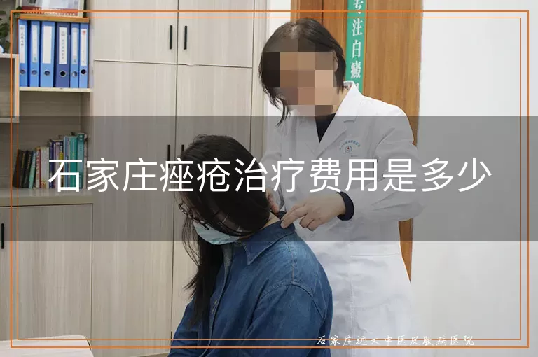 石家庄痤疮治疗费用是多少